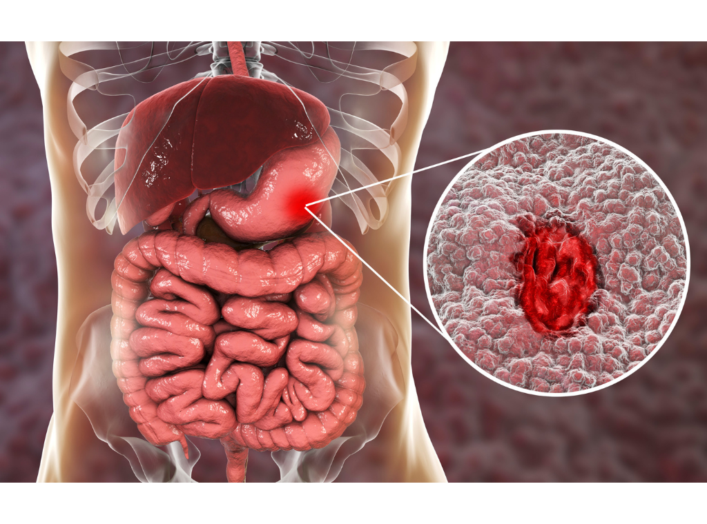 Gastrointestinal