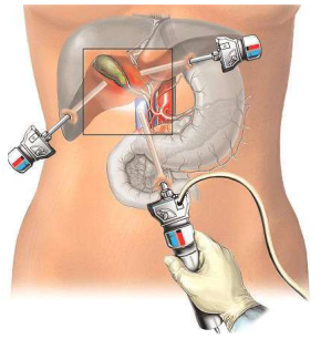 How Evaluating condition work