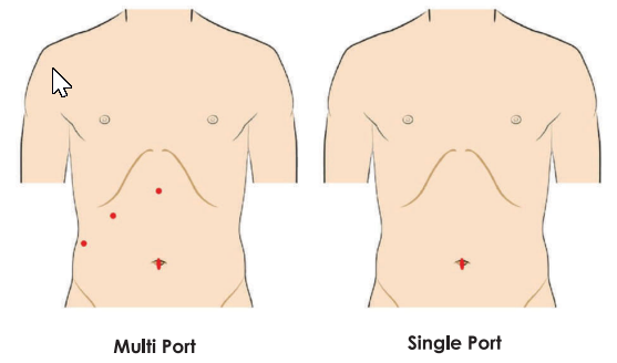 Multi port and Single Port