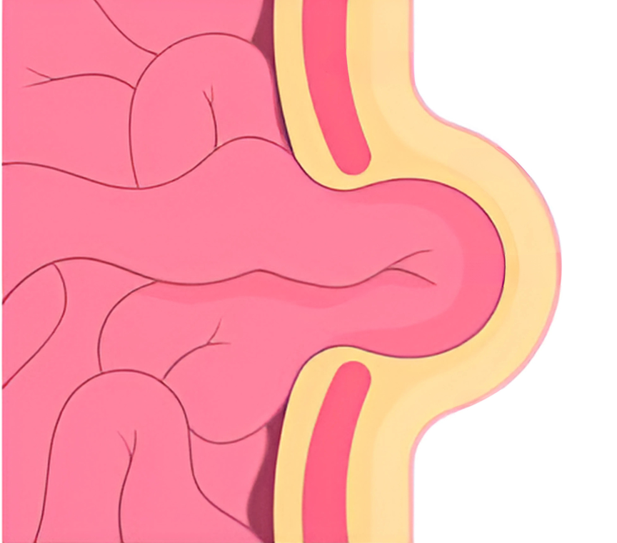 Ventral hernia