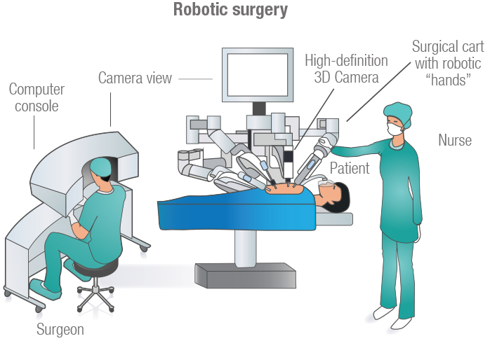 robotic surgery illustration